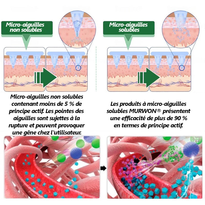 Approuvé par des experts médicaux 👩⚕️|𝑴𝙐𝗥𝓦𝐎𝙉® — 𝑩𝒆𝒓𝙗é𝙧𝐢𝐧𝐞 𝟔-𝒆𝒏-𝟏 𝙋𝙖𝙩𝙘𝙝 à 𝒎𝒊𝒄𝒓𝒐𝙣𝙚𝙚𝙙𝙡𝙚𝙨 𝐧𝐚𝐧𝐨🥦𝑺𝒐𝒖𝒕𝒆𝒏𝒖 𝘱𝘢𝘳 𝐥𝐚 𝐬𝐜𝐢𝐞𝐧𝐜𝐞 | 𝙵𝚘𝚛𝚖𝚞𝚕𝚎 6-𝓮𝓷-1 | 𝙍é𝙨𝙪𝙡𝙩𝙖𝙩𝙨 𝚎𝚗 𝟽 𝚓𝚘𝚞𝚛𝚜🪴