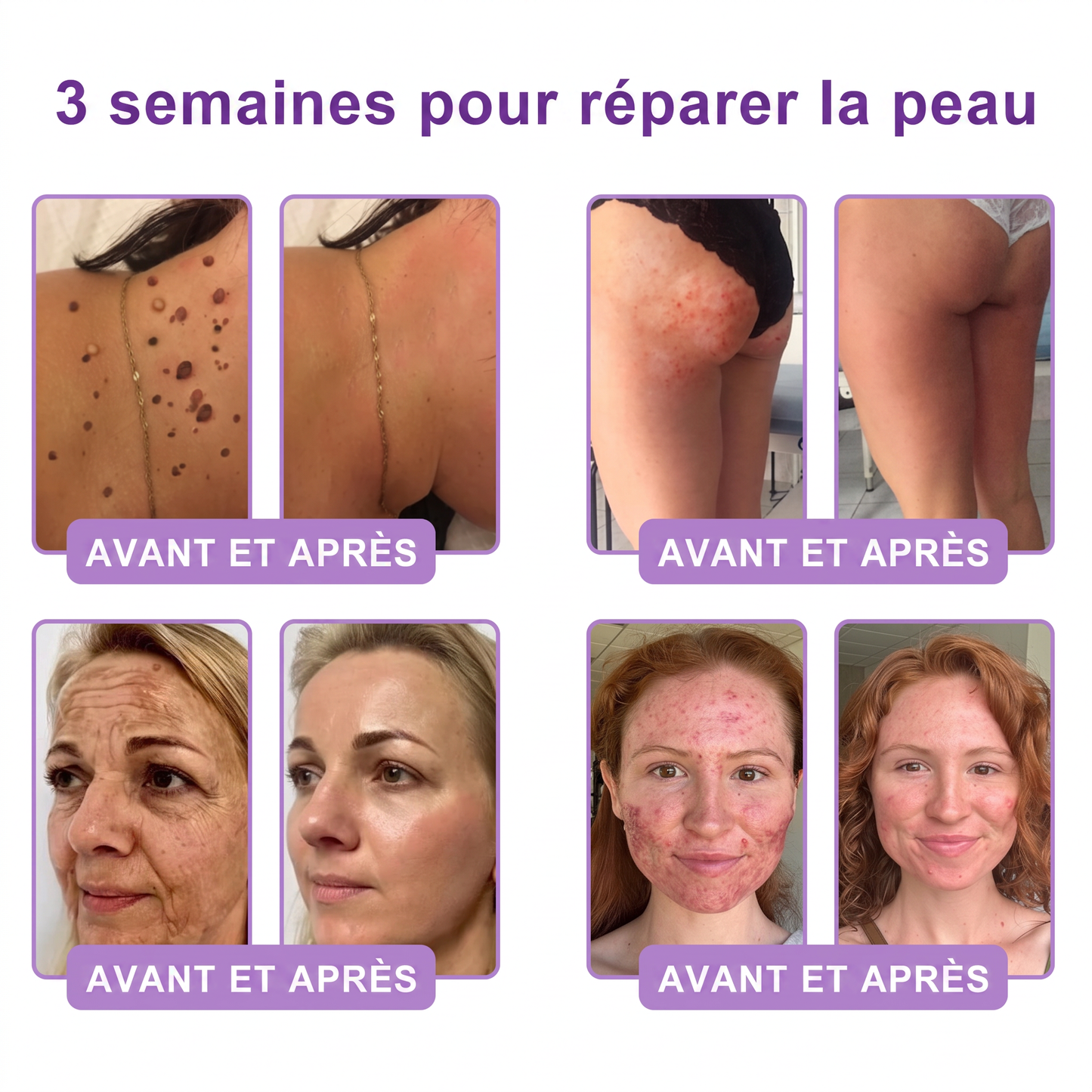 𝐕𝐢𝐭𝐚𝗹𝒊𝒔𝒚𝒔® 🌥️ 𝗣𝗗𝗥𝗡 𝐌𝐮𝗹𝘁𝗶-𝗣𝗲𝗽𝘁𝗶𝗱𝐞 𝐌𝐚𝐬𝐬𝐚𝐠𝐢𝐧𝐠 𝐁𝐨𝐝𝐲 𝐑𝐨𝐥𝐥𝐞𝐫 𝐂𝐫𝐞𝐚𝐦 — Anti-âge, Hydratant, Raffermissant & Liftant, Réparateur, Teint Unifié, Anti-Acné & Taches, Anti-Verrues & Grains de Beauté, Anti-Psoriasis.💙