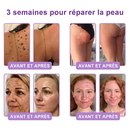 𝐕𝐢𝐭𝐚𝗹𝒊𝒔𝒚𝒔® 🌥️ 𝗣𝗗𝗥𝗡 𝐌𝐮𝗹𝘁𝗶-𝗣𝗲𝗽𝘁𝗶𝗱𝐞 𝐌𝐚𝐬𝐬𝐚𝐠𝐢𝐧𝐠 𝐁𝐨𝐝𝐲 𝐑𝐨𝐥𝐥𝐞𝐫 𝐂𝐫𝐞𝐚𝐦 — Anti-âge, Hydratant, Raffermissant & Liftant, Réparateur, Teint Unifié, Anti-Acné & Taches, Anti-Verrues & Grains de Beauté, Anti-Psoriasis.💙