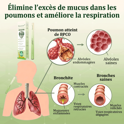 𝐃é𝐭𝐞𝐧𝐮𝐞 𝐞𝐭 𝐞𝐱𝐩𝐥𝐨𝐢𝐭é𝐞 𝐩𝐚𝐫 𝐥𝐚 𝐅𝐫𝐚𝐧𝐜𝐞✅𝑴𝒖𝒓𝙬𝙤𝐧® 𝑫𝒊𝒇𝒇𝒖𝒔𝒆𝒖𝒓 𝒅𝒆 𝑵𝒆𝒕𝒕𝒐𝒚𝒂𝒈𝒆 𝑷𝒖𝒍𝒎𝒐𝒏𝒂𝒊𝒓𝒆 à 𝒍𝒂 𝑴𝒐𝒍è𝒏𝒆 𝑩𝒐𝒕𝒂𝒏𝒊𝒒𝒖𝒆 (🫁 Toux, Pharyngite, essoufflement, expectorations, nez bouché, bronchite, symptômes allergiques, gêne pulmonaire)1❤️