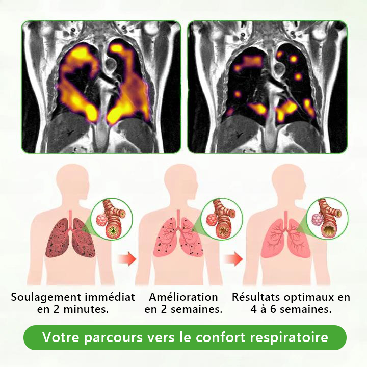 𝐃é𝐭𝐞𝐧𝐮𝐞 𝐞𝐭 𝐞𝐱𝐩𝐥𝐨𝐢𝐭é𝐞 𝐩𝐚𝐫 𝐥𝐚 𝐅𝐫𝐚𝐧𝐜𝐞✅ 𝑴𝒖𝒓𝙬𝙤𝐧® 𝑫𝒊𝒇𝒇𝒖𝒔𝒆𝒖𝒓 𝒅𝒆 𝑵𝒆𝒕𝒕𝒐𝒚𝒂𝒈𝒆 𝑷𝒖𝒍𝒎𝒐𝒏𝒂𝒊𝒓𝒆 à 𝒍𝒂 𝑴𝒐𝒍è𝒏𝒆 𝑩𝒐𝒕𝒂𝒏𝒊𝒒𝒖𝒆 (🫁 Toux, Pharyngite, essoufflement, expectorations, nez bouché, bronchite, symptômes allergiques, gêne pulmonaire)1🎉🎉