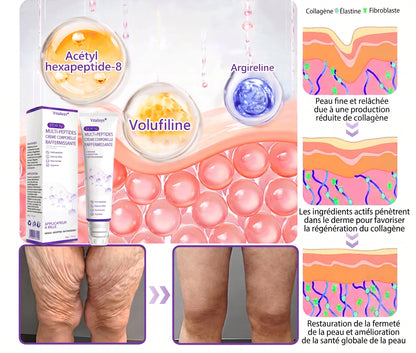 Boutique officielle✅ : Vitalisys® PDRN Crème Corps avec Roller ✨ – Anti-âge, hydratation, fermeté et régénération. Pour un teint unifié, traite acné, taches pigmentaires et verrues 🎁