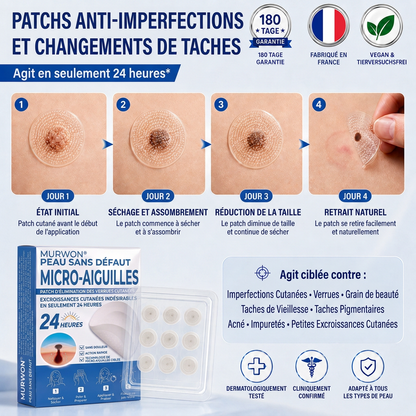 👩‍⚕️💯 𝘽𝙤𝙪𝙩𝙞𝒒𝒖𝒆 𝗢𝗳𝗳𝗶𝗰𝗶𝗲𝐥𝐥𝐞  | 𝑴𝑼𝑹𝑾𝑶𝑵® 🌿 𝑷𝒂𝒕𝒄𝒉𝒔 à 𝑴𝒊𝒄𝒓𝒐-𝒂𝒊𝒈𝒖𝒊𝒍𝒍𝒆𝒔 𝑨𝒏𝒕𝒊-𝑽𝒆𝒓𝒓𝒖𝒆𝒔 𝒆𝒕 𝑷𝒆𝒂𝒖 𝑵𝒆𝒕𝒕𝒆 (𝘗𝘰𝘶𝘳 𝘢𝘤𝘳𝘰𝘤𝘩𝘰𝘳𝘥𝘰𝘯𝘴, 𝘦𝘹𝘤𝘳𝘰𝘪𝘴𝘴𝘢𝘯𝘤𝘦𝘴 𝘤𝘶𝘵𝘢𝘯é𝘦𝘴, 𝘨𝘳𝘢𝘪𝘯𝘴 𝘥𝘦 𝘣𝘦𝘢𝘶𝘵é, 𝘵𝘢𝘤𝘩𝘦𝘴 𝘥𝘦 𝘷𝘪𝘦𝘪𝘭𝘭𝘦𝘴𝘴𝘦 𝘦𝘵 𝘱𝘪𝘨𝘮𝘦𝘯𝘵𝘢𝘵𝘪𝘰𝘯)🏵️