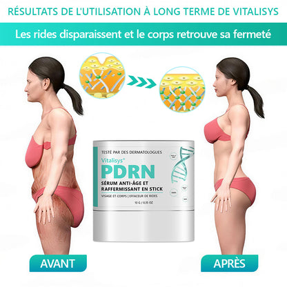 (🔥DERNIER JOUR : -70 %🔥) 𝐑𝐞𝐜𝐨𝐦𝐦𝐚𝐧𝐝é 𝐩𝐚𝐫 𝐥𝐞𝐬 𝐝𝐞𝐫𝐦𝐚𝐭𝐨𝐥𝐨𝐠𝐮𝐞𝐬 𝐟𝐫𝐚𝐧ç𝐚𝐢𝐬 ✨ 𝑺𝒕𝒊𝒄𝒌 𝑺é𝒓𝒖𝒎 𝑨𝒏𝒕𝒊-â𝒈𝒆 & 𝑹𝒂𝒇𝒇𝒆𝒓𝒎𝒊𝒔𝒔𝒂𝒏𝒕 𝑷𝗗𝑹𝑵 𝓥𝒊𝒕𝙖𝙡𝒊𝒔𝒚𝙨® ✨