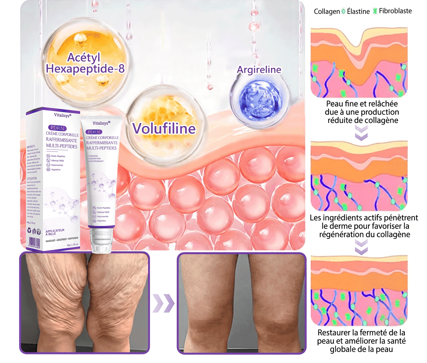 𝐕𝐢𝐭𝐚𝗹𝒊𝒔𝒚𝒔® 🌥️ 𝗣𝗗𝗥𝗡 𝐌𝐮𝗹𝘁𝗶-𝗣𝗲𝗽𝘁𝗶𝗱𝐞 𝐌𝐚𝐬𝐬𝐚𝐠𝐢𝐧𝐠 𝐁𝐨𝐝𝐲 𝐑𝐨𝐥𝐥𝐞𝐫 𝐂𝐫𝐞𝐚𝐦 — Anti-âge, Hydratant, Raffermissant & Liftant, Réparateur, Teint Unifié, Anti-Acné & Taches, Anti-Verrues & Grains de Beauté, Anti-Psoriasis.💙