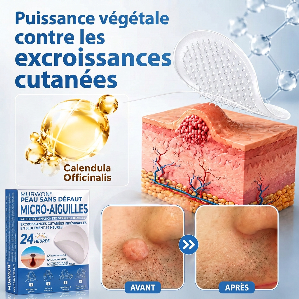 👩‍⚕️💯 𝘽𝙤𝙪𝙩𝙞𝒒𝒖𝒆 𝗢𝗳𝗳𝗶𝗰𝗶𝗲𝐥𝐥𝐞  | 𝑴𝑼𝑹𝑾𝑶𝑵® 🌿 𝑷𝒂𝒕𝒄𝒉𝒔 à 𝑴𝒊𝒄𝒓𝒐-𝒂𝒊𝒈𝒖𝒊𝒍𝒍𝒆𝒔 𝑨𝒏𝒕𝒊-𝑽𝒆𝒓𝒓𝒖𝒆𝒔 𝒆𝒕 𝑷𝒆𝒂𝒖 𝑵𝒆𝒕𝒕𝒆 (𝘗𝘰𝘶𝘳 𝘢𝘤𝘳𝘰𝘤𝘩𝘰𝘳𝘥𝘰𝘯𝘴, 𝘦𝘹𝘤𝘳𝘰𝘪𝘴𝘴𝘢𝘯𝘤𝘦𝘴 𝘤𝘶𝘵𝘢𝘯é𝘦𝘴, 𝘨𝘳𝘢𝘪𝘯𝘴 𝘥𝘦 𝘣𝘦𝘢𝘶𝘵é, 𝘵𝘢𝘤𝘩𝘦𝘴 𝘥𝘦 𝘷𝘪𝘦𝘪𝘭𝘭𝘦𝘴𝘴𝘦 𝘦𝘵 𝘱𝘪𝘨𝘮𝘦𝘯𝘵𝘢𝘵𝘪𝘰𝘯)🏵️