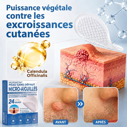 👩‍⚕️💯 𝘽𝙤𝙪𝙩𝙞𝒒𝒖𝒆 𝗢𝗳𝗳𝗶𝗰𝗶𝗲𝐥𝐥𝐞  | 𝑴𝑼𝑹𝑾𝑶𝑵® 🌿 𝑷𝒂𝒕𝒄𝒉𝒔 à 𝑴𝒊𝒄𝒓𝒐-𝒂𝒊𝒈𝒖𝒊𝒍𝒍𝒆𝒔 𝑨𝒏𝒕𝒊-𝑽𝒆𝒓𝒓𝒖𝒆𝒔 𝒆𝒕 𝑷𝒆𝒂𝒖 𝑵𝒆𝒕𝒕𝒆 (𝘗𝘰𝘶𝘳 𝘢𝘤𝘳𝘰𝘤𝘩𝘰𝘳𝘥𝘰𝘯𝘴, 𝘦𝘹𝘤𝘳𝘰𝘪𝘴𝘴𝘢𝘯𝘤𝘦𝘴 𝘤𝘶𝘵𝘢𝘯é𝘦𝘴, 𝘨𝘳𝘢𝘪𝘯𝘴 𝘥𝘦 𝘣𝘦𝘢𝘶𝘵é, 𝘵𝘢𝘤𝘩𝘦𝘴 𝘥𝘦 𝘷𝘪𝘦𝘪𝘭𝘭𝘦𝘴𝘴𝘦 𝘦𝘵 𝘱𝘪𝘨𝘮𝘦𝘯𝘵𝘢𝘵𝘪𝘰𝘯)🏵️