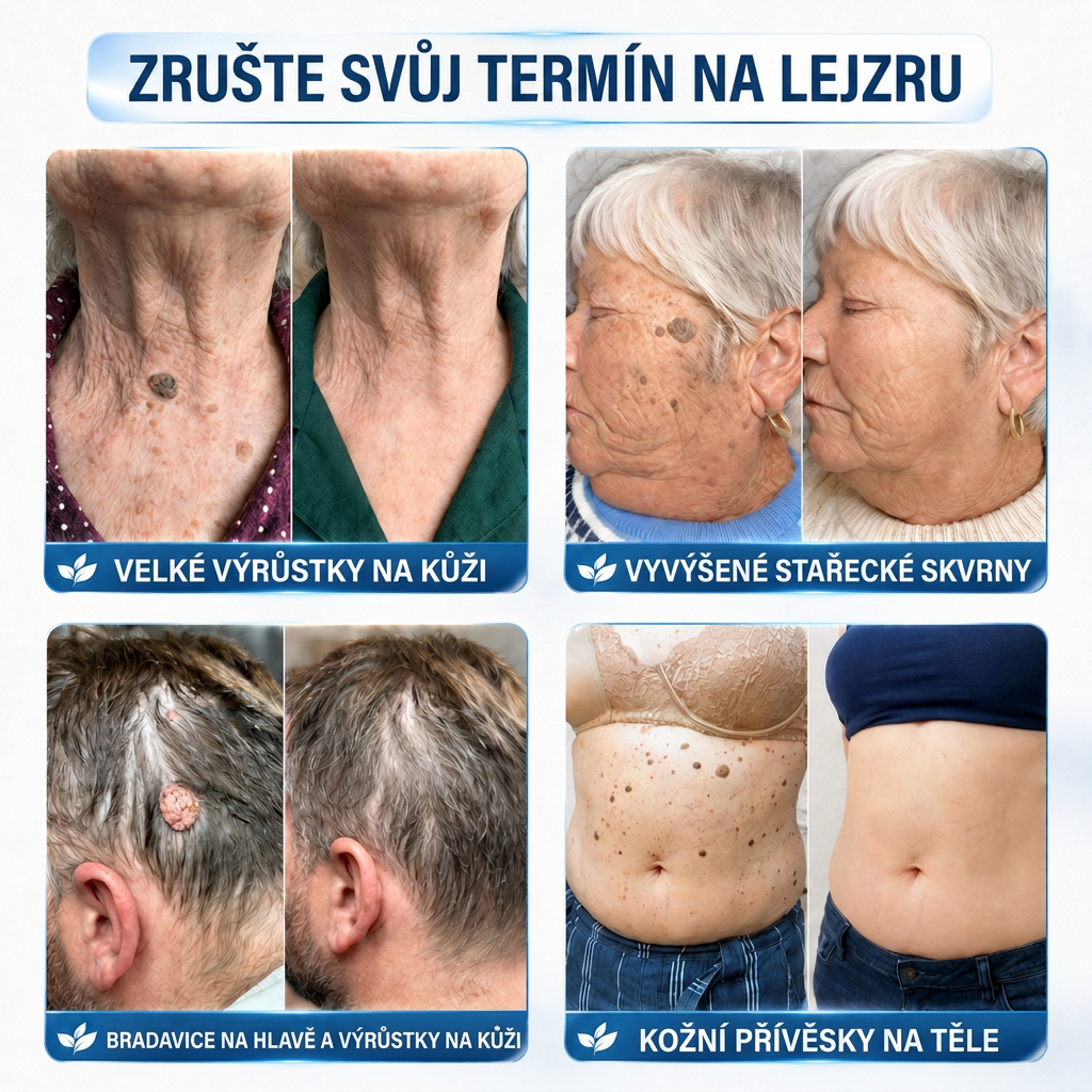 👩‍⚕️💯 𝘽𝙤𝙪𝙩𝙞𝒒𝒖𝒆 𝗢𝗳𝗳𝗶𝗰𝗶𝗲𝐥𝐥𝐞  | 𝑴𝑼𝑹𝑾𝑶𝑵® 🌿 𝑷𝒂𝒕𝒄𝒉𝒔 à 𝑴𝒊𝒄𝒓𝒐-𝒂𝒊𝒈𝒖𝒊𝒍𝒍𝒆𝒔 𝑨𝒏𝒕𝒊-𝑽𝒆𝒓𝒓𝒖𝒆𝒔 𝒆𝒕 𝑷𝒆𝒂𝒖 𝑵𝒆𝒕𝒕𝒆 (𝘗𝘰𝘶𝘳 𝘢𝘤𝘳𝘰𝘤𝘩𝘰𝘳𝘥𝘰𝘯𝘴, 𝘦𝘹𝘤𝘳𝘰𝘪𝘴𝘴𝘢𝘯𝘤𝘦𝘴 𝘤𝘶𝘵𝘢𝘯é𝘦𝘴, 𝘨𝘳𝘢𝘪𝘯𝘴 𝘥𝘦 𝘣𝘦𝘢𝘶𝘵é, 𝘵𝘢𝘤𝘩𝘦𝘴 𝘥𝘦 𝘷𝘪𝘦𝘪𝘭𝘭𝘦𝘴𝘴𝘦 𝘦𝘵 𝘱𝘪𝘨𝘮𝘦𝘯𝘵𝘢𝘵𝘪𝘰𝘯)🌿