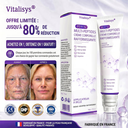 Boutique officielle✅ : Vitalisys® PDRN Crème Corps avec Roller ✨ – Anti-âge, hydratation, fermeté et régénération. Pour un teint unifié, traite acné, taches pigmentaires et verrues 🎁