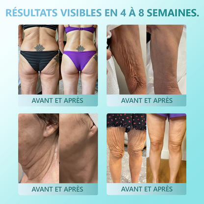 (🔥DERNIER JOUR : -70 %🔥) 𝐑𝐞𝐜𝐨𝐦𝐦𝐚𝐧𝐝é 𝐩𝐚𝐫 𝐥𝐞𝐬 𝐝𝐞𝐫𝐦𝐚𝐭𝐨𝐥𝐨𝐠𝐮𝐞𝐬 𝐟𝐫𝐚𝐧ç𝐚𝐢𝐬 ✨ 𝑺𝒕𝒊𝒄𝒌 𝑺é𝒓𝒖𝒎 𝑨𝒏𝒕𝒊-â𝒈𝒆 & 𝑹𝒂𝒇𝒇𝒆𝒓𝒎𝒊𝒔𝒔𝒂𝒏𝒕 𝑷𝗗𝑹𝑵 𝓥𝒊𝒕𝙖𝙡𝒊𝒔𝒚𝙨® ✨