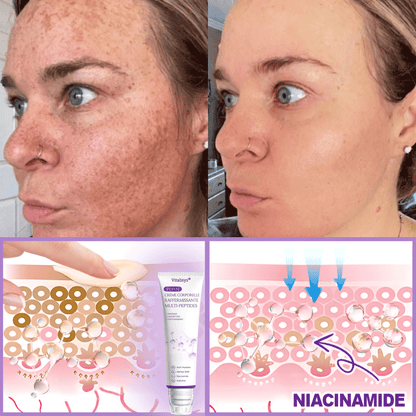 𝐕𝐢𝐭𝐚𝗹𝒊𝒔𝒚𝒔® 🌥️ 𝗣𝗗𝗥𝗡 𝐌𝐮𝗹𝘁𝗶-𝗣𝗲𝗽𝘁𝗶𝗱𝐞 𝐌𝐚𝐬𝐬𝐚𝐠𝐢𝐧𝐠 𝐁𝐨𝐝𝐲 𝐑𝐨𝐥𝐥𝐞𝐫 𝐂𝐫𝐞𝐚𝐦 — Anti-âge, Hydratant, Raffermissant & Liftant, Réparateur, Teint Unifié, Anti-Acné & Taches, Anti-Verrues & Grains de Beauté, Anti-Psoriasis.💙