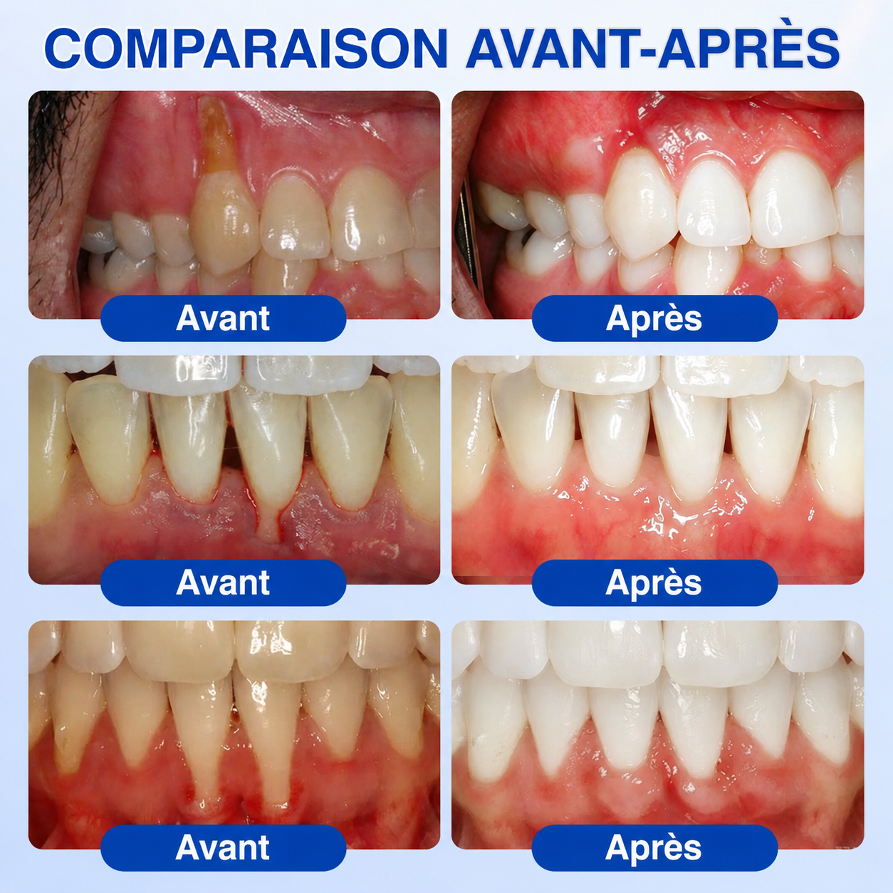 𝐑𝐞𝐜𝐨𝐦𝐦𝐚𝐧𝐝é 𝐩𝐚𝐫 𝐥𝐞𝐬 𝐩𝐡𝐚𝐫𝐦𝐚𝐜𝐢𝐞𝐧𝐬✨ 𝑽𝐢𝘁𝒂𝒍𝒊𝒔𝒚𝒔®🦷 𝑮𝒖𝒎𝑹𝒆𝒗𝒊𝒗𝒆 𝑮𝒆𝒍 𝒅𝒆 𝑹é𝒑𝒂𝒓𝒂𝒕𝒊𝒐𝒏 𝑷𝒂𝒓𝒐𝒅𝒐𝒏𝒕𝒂𝒍𝒆💕