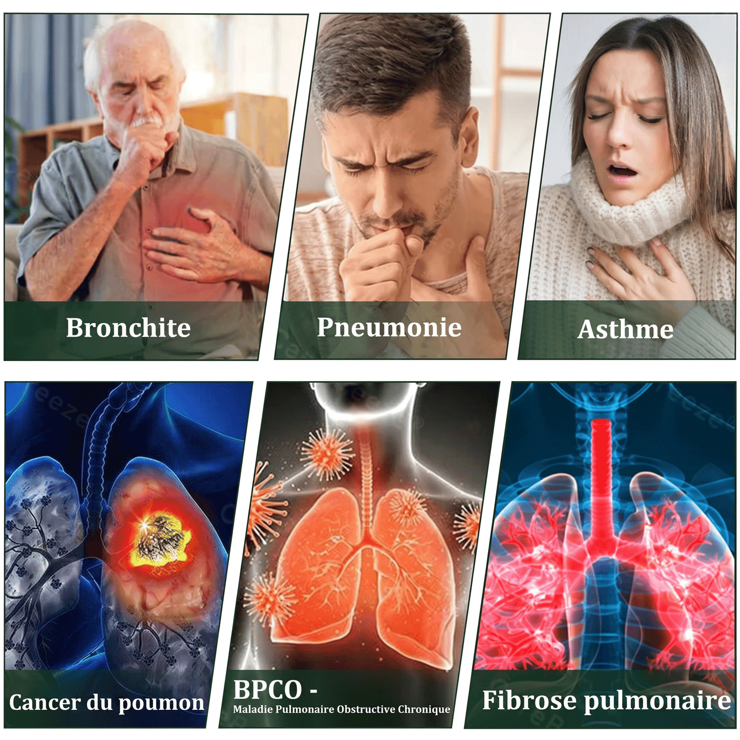 𝐃é𝐭𝐞𝐧𝐮𝐞 𝐞𝐭 𝐞𝐱𝐩𝐥𝐨𝐢𝐭é𝐞 𝐩𝐚𝐫 𝐥𝐚 𝐅𝐫𝐚𝐧𝐜𝐞✅𝑴𝒖𝒓𝙬𝙤𝐧® 𝑫𝒊𝒇𝒇𝒖𝒔𝒆𝒖𝒓 𝒅𝒆 𝑵𝒆𝒕𝒕𝒐𝒚𝒂𝒈𝒆 𝑷𝒖𝒍𝒎𝒐𝒏𝒂𝒊𝒓𝒆 à 𝒍𝒂 𝑴𝒐𝒍è𝒏𝒆 𝑩𝒐𝒕𝒂𝒏𝒊𝒒𝒖𝒆 (🫁 Toux, Pharyngite, essoufflement, expectorations, nez bouché, bronchite, symptômes allergiques, gêne pulmonaire)1❤️