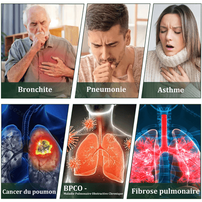 𝐃é𝐭𝐞𝐧𝐮𝐞 𝐞𝐭 𝐞𝐱𝐩𝐥𝐨𝐢𝐭é𝐞 𝐩𝐚𝐫 𝐥𝐚 𝐅𝐫𝐚𝐧𝐜𝐞✅𝑴𝒖𝒓𝙬𝙤𝐧® 𝑫𝒊𝒇𝒇𝒖𝒔𝒆𝒖𝒓 𝒅𝒆 𝑵𝒆𝒕𝒕𝒐𝒚𝒂𝒈𝒆 𝑷𝒖𝒍𝒎𝒐𝒏𝒂𝒊𝒓𝒆 à 𝒍𝒂 𝑴𝒐𝒍è𝒏𝒆 𝑩𝒐𝒕𝒂𝒏𝒊𝒒𝒖𝒆 (🫁 Toux, Pharyngite, essoufflement, expectorations, nez bouché, bronchite, symptômes allergiques, gêne pulmonaire)1❤️