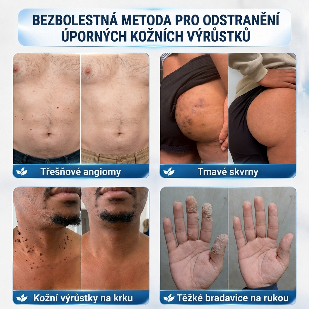 👩‍⚕️💯 𝘽𝙤𝙪𝙩𝙞𝒒𝒖𝒆 𝗢𝗳𝗳𝗶𝗰𝗶𝗲𝐥𝐥𝐞  | 𝑴𝑼𝑹𝑾𝑶𝑵® 🌿 𝑷𝒂𝒕𝒄𝒉𝒔 à 𝑴𝒊𝒄𝒓𝒐-𝒂𝒊𝒈𝒖𝒊𝒍𝒍𝒆𝒔 𝑨𝒏𝒕𝒊-𝑽𝒆𝒓𝒓𝒖𝒆𝒔 𝒆𝒕 𝑷𝒆𝒂𝒖 𝑵𝒆𝒕𝒕𝒆 (𝘗𝘰𝘶𝘳 𝘢𝘤𝘳𝘰𝘤𝘩𝘰𝘳𝘥𝘰𝘯𝘴, 𝘦𝘹𝘤𝘳𝘰𝘪𝘴𝘴𝘢𝘯𝘤𝘦𝘴 𝘤𝘶𝘵𝘢𝘯é𝘦𝘴, 𝘨𝘳𝘢𝘪𝘯𝘴 𝘥𝘦 𝘣𝘦𝘢𝘶𝘵é, 𝘵𝘢𝘤𝘩𝘦𝘴 𝘥𝘦 𝘷𝘪𝘦𝘪𝘭𝘭𝘦𝘴𝘴𝘦 𝘦𝘵 𝘱𝘪𝘨𝘮𝘦𝘯𝘵𝘢𝘵𝘪𝘰𝘯)🌿