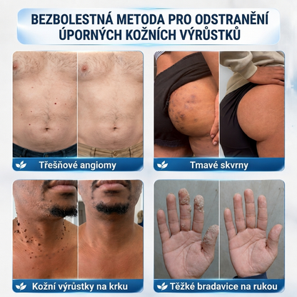 👩‍⚕️💯 𝘽𝙤𝙪𝙩𝙞𝒒𝒖𝒆 𝗢𝗳𝗳𝗶𝗰𝗶𝗲𝐥𝐥𝐞  | 𝑴𝑼𝑹𝑾𝑶𝑵® 🌿 𝑷𝒂𝒕𝒄𝒉𝒔 à 𝑴𝒊𝒄𝒓𝒐-𝒂𝒊𝒈𝒖𝒊𝒍𝒍𝒆𝒔 𝑨𝒏𝒕𝒊-𝑽𝒆𝒓𝒓𝒖𝒆𝒔 𝒆𝒕 𝑷𝒆𝒂𝒖 𝑵𝒆𝒕𝒕𝒆 (𝘗𝘰𝘶𝘳 𝘢𝘤𝘳𝘰𝘤𝘩𝘰𝘳𝘥𝘰𝘯𝘴, 𝘦𝘹𝘤𝘳𝘰𝘪𝘴𝘴𝘢𝘯𝘤𝘦𝘴 𝘤𝘶𝘵𝘢𝘯é𝘦𝘴, 𝘨𝘳𝘢𝘪𝘯𝘴 𝘥𝘦 𝘣𝘦𝘢𝘶𝘵é, 𝘵𝘢𝘤𝘩𝘦𝘴 𝘥𝘦 𝘷𝘪𝘦𝘪𝘭𝘭𝘦𝘴𝘴𝘦 𝘦𝘵 𝘱𝘪𝘨𝘮𝘦𝘯𝘵𝘢𝘵𝘪𝘰𝘯)🌿