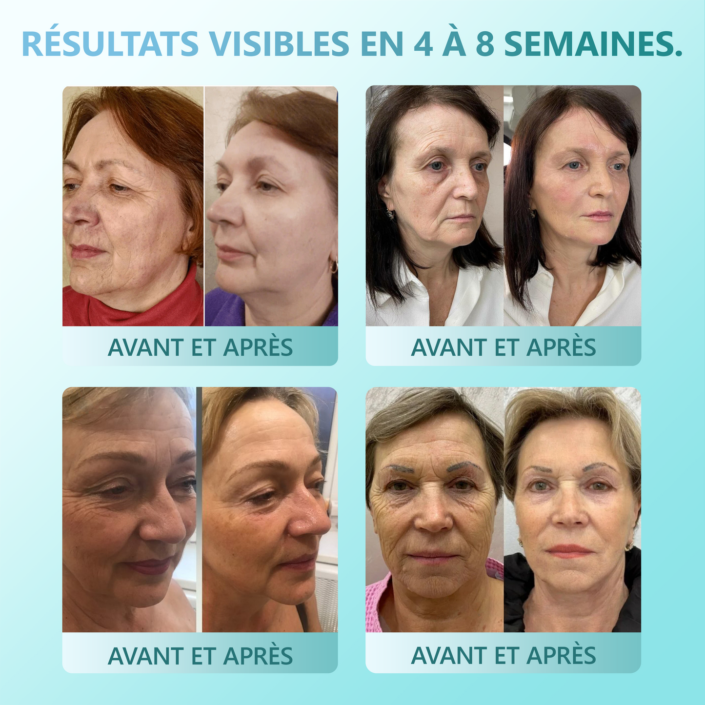 (🔥DERNIER JOUR : -70 %🔥) 𝐑𝐞𝐜𝐨𝐦𝐦𝐚𝐧𝐝é 𝐩𝐚𝐫 𝐥𝐞𝐬 𝐝𝐞𝐫𝐦𝐚𝐭𝐨𝐥𝐨𝐠𝐮𝐞𝐬 𝐟𝐫𝐚𝐧ç𝐚𝐢𝐬 ✨ 𝑺𝒕𝒊𝒄𝒌 𝑺é𝒓𝒖𝒎 𝑨𝒏𝒕𝒊-â𝒈𝒆 & 𝑹𝒂𝒇𝒇𝒆𝒓𝒎𝒊𝒔𝒔𝒂𝒏𝒕 𝑷𝗗𝑹𝑵 𝓥𝒊𝒕𝙖𝙡𝒊𝒔𝒚𝙨® ✨