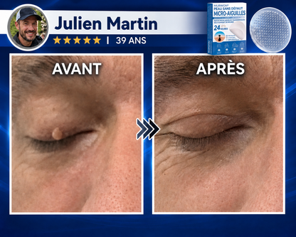 👩‍⚕️💯 𝘽𝙤𝙪𝙩𝙞𝒒𝒖𝒆 𝗢𝗳𝗳𝗶𝗰𝗶𝗲𝐥𝐥𝐞  | 𝑴𝑼𝑹𝑾𝑶𝑵® 🌿 𝑷𝒂𝒕𝒄𝒉𝒔 à 𝑴𝒊𝒄𝒓𝒐-𝒂𝒊𝒈𝒖𝒊𝒍𝒍𝒆𝒔 𝑨𝒏𝒕𝒊-𝑽𝒆𝒓𝒓𝒖𝒆𝒔 𝒆𝒕 𝑷𝒆𝒂𝒖 𝑵𝒆𝒕𝒕𝒆 (𝘗𝘰𝘶𝘳 𝘢𝘤𝘳𝘰𝘤𝘩𝘰𝘳𝘥𝘰𝘯𝘴, 𝘦𝘹𝘤𝘳𝘰𝘪𝘴𝘴𝘢𝘯𝘤𝘦𝘴 𝘤𝘶𝘵𝘢𝘯é𝘦𝘴, 𝘨𝘳𝘢𝘪𝘯𝘴 𝘥𝘦 𝘣𝘦𝘢𝘶𝘵é, 𝘵𝘢𝘤𝘩𝘦𝘴 𝘥𝘦 𝘷𝘪𝘦𝘪𝘭𝘭𝘦𝘴𝘴𝘦 𝘦𝘵 𝘱𝘪𝘨𝘮𝘦𝘯𝘵𝘢𝘵𝘪𝘰𝘯)🏵️