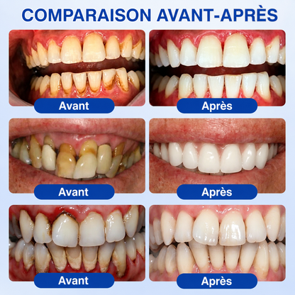 𝐑𝐞𝐜𝐨𝐦𝐦𝐚𝐧𝐝é 𝐩𝐚𝐫 𝐥𝐞𝐬 𝐩𝐡𝐚𝐫𝐦𝐚𝐜𝐢𝐞𝐧𝐬✨ 𝑽𝐢𝘁𝒂𝒍𝒊𝒔𝒚𝒔®🦷 𝑮𝒖𝒎𝑹𝒆𝒗𝒊𝒗𝒆 𝑮𝒆𝒍 𝒅𝒆 𝑹é𝒑𝒂𝒓𝒂𝒕𝒊𝒐𝒏 𝑷𝒂𝒓𝒐𝒅𝒐𝒏𝒕𝒂𝒍𝒆💕