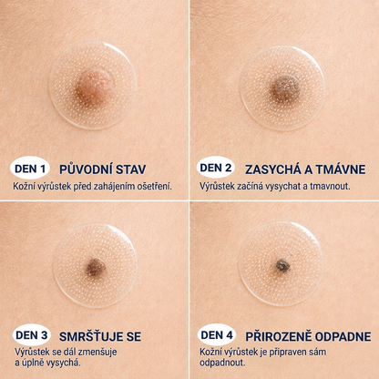 👩‍⚕️💯 𝘽𝙤𝙪𝙩𝙞𝒒𝒖𝒆 𝗢𝗳𝗳𝗶𝗰𝗶𝗲𝐥𝐥𝐞  | 𝑴𝑼𝑹𝑾𝑶𝑵® 🌿 𝑷𝒂𝒕𝒄𝒉𝒔 à 𝑴𝒊𝒄𝒓𝒐-𝒂𝒊𝒈𝒖𝒊𝒍𝒍𝒆𝒔 𝑨𝒏𝒕𝒊-𝑽𝒆𝒓𝒓𝒖𝒆𝒔 𝒆𝒕 𝑷𝒆𝒂𝒖 𝑵𝒆𝒕𝒕𝒆 (𝘗𝘰𝘶𝘳 𝘢𝘤𝘳𝘰𝘤𝘩𝘰𝘳𝘥𝘰𝘯𝘴, 𝘦𝘹𝘤𝘳𝘰𝘪𝘴𝘴𝘢𝘯𝘤𝘦𝘴 𝘤𝘶𝘵𝘢𝘯é𝘦𝘴, 𝘨𝘳𝘢𝘪𝘯𝘴 𝘥𝘦 𝘣𝘦𝘢𝘶𝘵é, 𝘵𝘢𝘤𝘩𝘦𝘴 𝘥𝘦 𝘷𝘪𝘦𝘪𝘭𝘭𝘦𝘴𝘴𝘦 𝘦𝘵 𝘱𝘪𝘨𝘮𝘦𝘯𝘵𝘢𝘵𝘪𝘰𝘯)🌿
