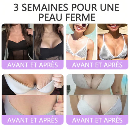 Boutique officielle✅ : Vitalisys® PDRN Crème Corps avec Roller ✨ – Anti-âge, hydratation, fermeté et régénération. Pour un teint unifié, traite acné, taches pigmentaires et verrues 🎁