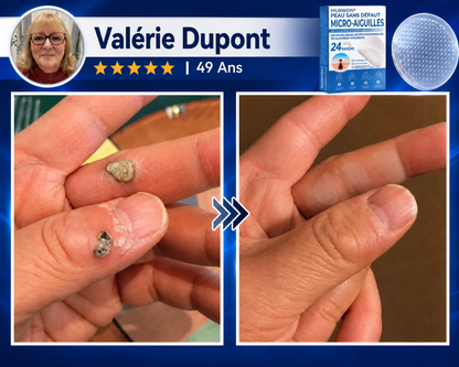 👩‍⚕️💯 𝘽𝙤𝙪𝙩𝙞𝒒𝒖𝒆 𝗢𝗳𝗳𝗶𝗰𝗶𝗲𝐥𝐥𝐞  | 𝑴𝑼𝑹𝑾𝑶𝑵® 🌿 𝑷𝒂𝒕𝒄𝒉𝒔 à 𝑴𝒊𝒄𝒓𝒐-𝒂𝒊𝒈𝒖𝒊𝒍𝒍𝒆𝒔 𝑨𝒏𝒕𝒊-𝑽𝒆𝒓𝒓𝒖𝒆𝒔 𝒆𝒕 𝑷𝒆𝒂𝒖 𝑵𝒆𝒕𝒕𝒆 (𝘗𝘰𝘶𝘳 𝘢𝘤𝘳𝘰𝘤𝘩𝘰𝘳𝘥𝘰𝘯𝘴, 𝘦𝘹𝘤𝘳𝘰𝘪𝘴𝘴𝘢𝘯𝘤𝘦𝘴 𝘤𝘶𝘵𝘢𝘯é𝘦𝘴, 𝘨𝘳𝘢𝘪𝘯𝘴 𝘥𝘦 𝘣𝘦𝘢𝘶𝘵é, 𝘵𝘢𝘤𝘩𝘦𝘴 𝘥𝘦 𝘷𝘪𝘦𝘪𝘭𝘭𝘦𝘴𝘴𝘦 𝘦𝘵 𝘱𝘪𝘨𝘮𝘦𝘯𝘵𝘢𝘵𝘪𝘰𝘯)🏵️