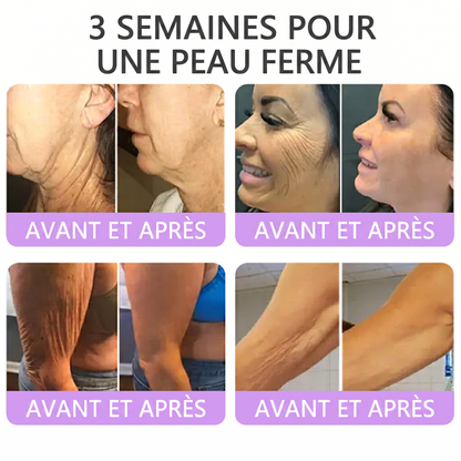 Boutique officielle✅ : Vitalisys® PDRN Crème Corps avec Roller ✨ – Anti-âge, hydratation, fermeté et régénération. Pour un teint unifié, traite acné, taches pigmentaires et verrues 🎁