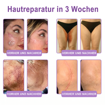 30 % DE RÉDUCTION🎁✨𝐕𝐢𝐭𝐚𝗹𝒊𝒔𝒚𝒔®  𝗣𝗗𝗥𝗡 𝐌𝐮𝗹𝘁𝗶-𝗣𝗲𝗽𝘁𝗶𝗱𝐞 𝐌𝐚𝐬𝐬𝐚𝐠𝐢𝐧𝐠 𝐁𝐨𝐝𝐲 𝐑𝐨𝐥𝐥𝐞𝐫 𝐂𝐫𝐞𝐚𝐦 — Anti-âge, Hydratant, Raffermissant & Liftant, Réparateur, Teint Unifié, Anti-Acné & Taches, Anti-Verrues & Grains de Beauté, Anti-Psoriasis.