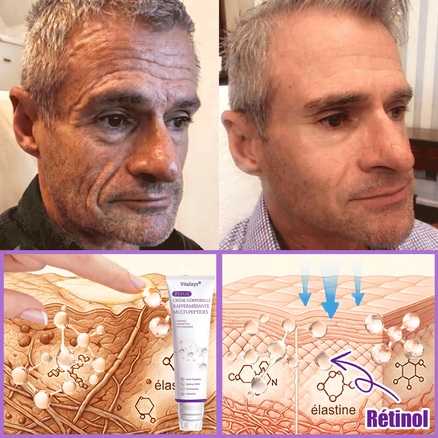 𝐕𝐢𝐭𝐚𝗹𝒊𝒔𝒚𝒔® 🌥️ 𝗣𝗗𝗥𝗡 𝐌𝐮𝗹𝘁𝗶-𝗣𝗲𝗽𝘁𝗶𝗱𝐞 𝐌𝐚𝐬𝐬𝐚𝐠𝐢𝐧𝐠 𝐁𝐨𝐝𝐲 𝐑𝐨𝐥𝐥𝐞𝐫 𝐂𝐫𝐞𝐚𝐦 — Anti-âge, Hydratant, Raffermissant & Liftant, Réparateur, Teint Unifié, Anti-Acné & Taches, Anti-Verrues & Grains de Beauté, Anti-Psoriasis.💙