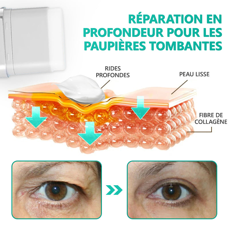 (🔥DERNIER JOUR : -70 %🔥) 𝐑𝐞𝐜𝐨𝐦𝐦𝐚𝐧𝐝é 𝐩𝐚𝐫 𝐥𝐞𝐬 𝐝𝐞𝐫𝐦𝐚𝐭𝐨𝐥𝐨𝐠𝐮𝐞𝐬 𝐟𝐫𝐚𝐧ç𝐚𝐢𝐬 ✨ 𝑺𝒕𝒊𝒄𝒌 𝑺é𝒓𝒖𝒎 𝑨𝒏𝒕𝒊-â𝒈𝒆 & 𝑹𝒂𝒇𝒇𝒆𝒓𝒎𝒊𝒔𝒔𝒂𝒏𝒕 𝑷𝗗𝑹𝑵 𝓥𝒊𝒕𝙖𝙡𝒊𝒔𝒚𝙨® ✨