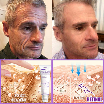 Boutique officielle✅ : Vitalisys® PDRN Crème Corps avec Roller ✨ – Anti-âge, hydratation, fermeté et régénération. Pour un teint unifié, traite acné, taches pigmentaires et verrues 🎁