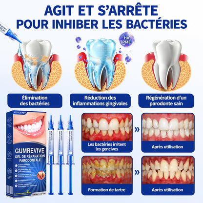 𝐑𝐞𝐜𝐨𝐦𝐦𝐚𝐧𝐝é 𝐩𝐚𝐫 𝐥𝐞𝐬 𝐩𝐡𝐚𝐫𝐦𝐚𝐜𝐢𝐞𝐧𝐬✨ 𝑽𝐢𝘁𝒂𝒍𝒊𝒔𝒚𝒔®🦷 𝑮𝒖𝒎𝑹𝒆𝒗𝒊𝒗𝒆 𝑮𝒆𝒍 𝒅𝒆 𝑹é𝒑𝒂𝒓𝒂𝒕𝒊𝒐𝒏 𝑷𝒂𝒓𝒐𝒅𝒐𝒏𝒕𝒂𝒍𝒆💕