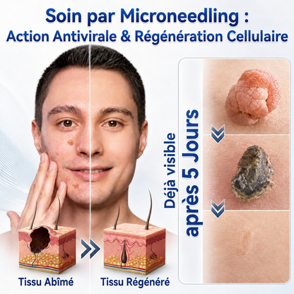 👩‍⚕️💯 𝘽𝙤𝙪𝙩𝙞𝒒𝒖𝒆 𝗢𝗳𝗳𝗶𝗰𝗶𝗲𝐥𝐥𝐞  | 𝑴𝑼𝑹𝑾𝑶𝑵® 🌿 𝑷𝒂𝒕𝒄𝒉𝒔 à 𝑴𝒊𝒄𝒓𝒐-𝒂𝒊𝒈𝒖𝒊𝒍𝒍𝒆𝒔 𝑨𝒏𝒕𝒊-𝑽𝒆𝒓𝒓𝒖𝒆𝒔 𝒆𝒕 𝑷𝒆𝒂𝒖 𝑵𝒆𝒕𝒕𝒆 (𝘗𝘰𝘶𝘳 𝘢𝘤𝘳𝘰𝘤𝘩𝘰𝘳𝘥𝘰𝘯𝘴, 𝘦𝘹𝘤𝘳𝘰𝘪𝘴𝘴𝘢𝘯𝘤𝘦𝘴 𝘤𝘶𝘵𝘢𝘯é𝘦𝘴, 𝘨𝘳𝘢𝘪𝘯𝘴 𝘥𝘦 𝘣𝘦𝘢𝘶𝘵é, 𝘵𝘢𝘤𝘩𝘦𝘴 𝘥𝘦 𝘷𝘪𝘦𝘪𝘭𝘭𝘦𝘴𝘴𝘦 𝘦𝘵 𝘱𝘪𝘨𝘮𝘦𝘯𝘵𝘢𝘵𝘪𝘰𝘯)🏵️
