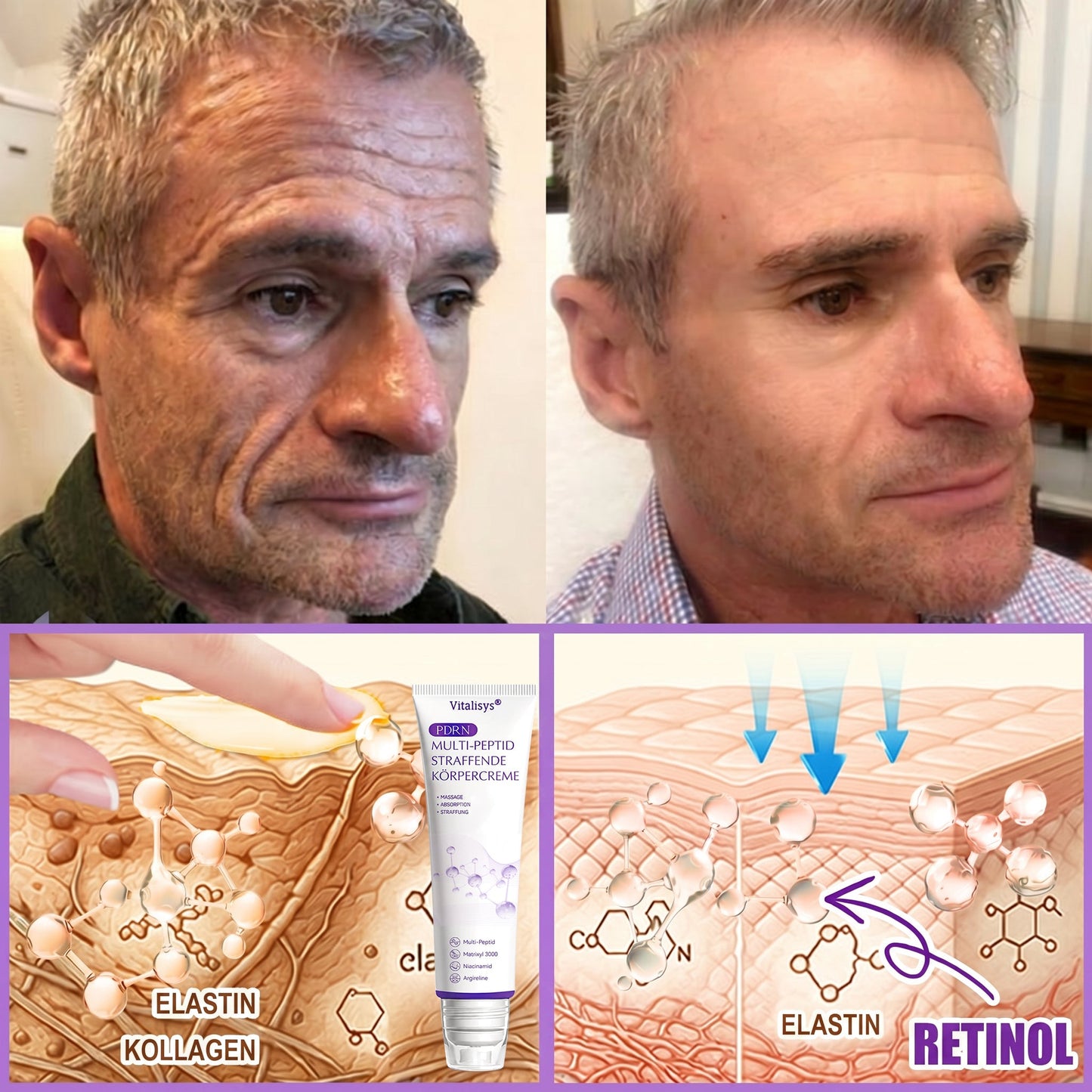30 % DE RÉDUCTION🎁✨𝐕𝐢𝐭𝐚𝗹𝒊𝒔𝒚𝒔®  𝗣𝗗𝗥𝗡 𝐌𝐮𝗹𝘁𝗶-𝗣𝗲𝗽𝘁𝗶𝗱𝐞 𝐌𝐚𝐬𝐬𝐚𝐠𝐢𝐧𝐠 𝐁𝐨𝐝𝐲 𝐑𝐨𝐥𝐥𝐞𝐫 𝐂𝐫𝐞𝐚𝐦 — Anti-âge, Hydratant, Raffermissant & Liftant, Réparateur, Teint Unifié, Anti-Acné & Taches, Anti-Verrues & Grains de Beauté, Anti-Psoriasis.