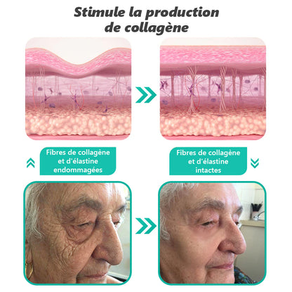 (🔥DERNIER JOUR : -70 %🔥) 𝐑𝐞𝐜𝐨𝐦𝐦𝐚𝐧𝐝é 𝐩𝐚𝐫 𝐥𝐞𝐬 𝐝𝐞𝐫𝐦𝐚𝐭𝐨𝐥𝐨𝐠𝐮𝐞𝐬 𝐟𝐫𝐚𝐧ç𝐚𝐢𝐬 ✨ 𝑺𝒕𝒊𝒄𝒌 𝑺é𝒓𝒖𝒎 𝑨𝒏𝒕𝒊-â𝒈𝒆 & 𝑹𝒂𝒇𝒇𝒆𝒓𝒎𝒊𝒔𝒔𝒂𝒏𝒕 𝑷𝗗𝑹𝑵 𝓥𝒊𝒕𝙖𝙡𝒊𝒔𝒚𝙨® ✨